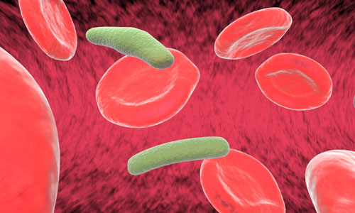 What Are The Symptoms Of Anemia?