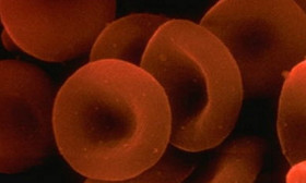 What Are The Symptoms Of Anemia