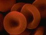 What Are The Symptoms Of Anemia?