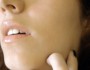 All You Wanted To Know About Collagen Implants