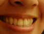 7 Ways to Keep Your Lips Smooth In Winter  