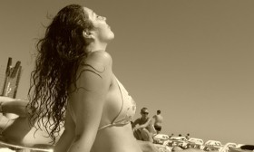 How to Treat Sunburns?