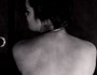 7 Rare Skin Diseases