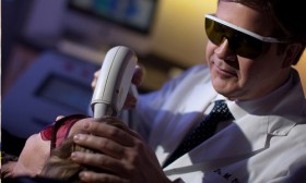 Top 4 Side Effects of Laser Hair Removal