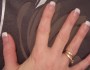 How to Treat Splitting Fingernails?