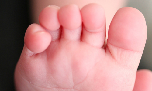 5 Tips to Take Care of Your Toes