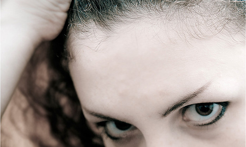 Top 3 Causes Of Eyebrow Hair Loss