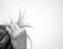 10 Side Effects of Hair Transplant Surgery