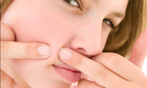 9 Things to Know If You have Acne Prone Skin 