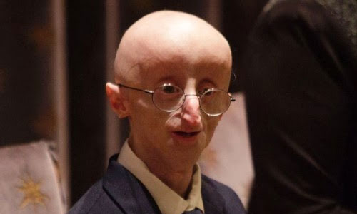 6 Things to Know About Sam Berns Who had Progeria