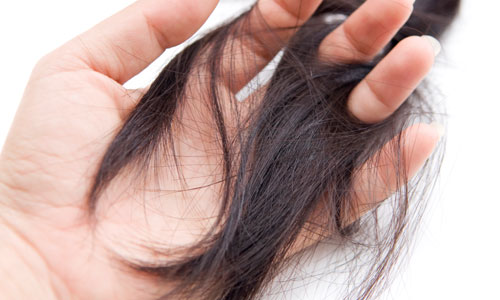 Home Remedies to Prevent Hair Loss