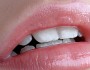 5 Ideas To Get Luscious Lips