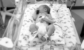 How To Take Care Of A Prematured Delivered Baby?