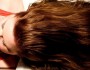 Top 8 Reasons For Hair Loss
