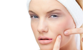 How To Prevent Pimples?