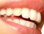 9 Facts About Teeth Whitening You Didn't Know