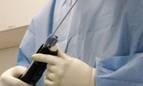 Pros and Cons of Liposuction