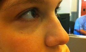 How to Reduce Pores On Skin?