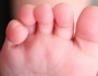 5 Tips to Take Care of Your Toes