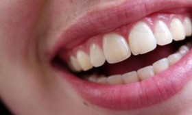 3 Ways for Instant Teeth Whitening at Home