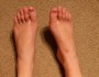 7 Ways to Prevent Shoe Bite