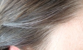 10 Causes of Premature Graying of Hair
