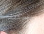 10 Causes of Premature Graying of Hair