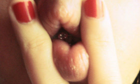 6 Good Remedies for Chapped Lips