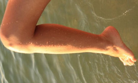 10 Tips to Prevent Cracked Heels