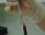 7 Things to Consider Before Donating Blood