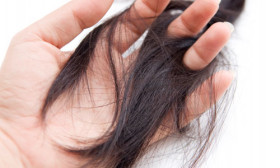 8 Tips to Cope With Hair Loss