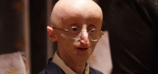 things-to-know-about-Sam-Berns-who-had-Progeria